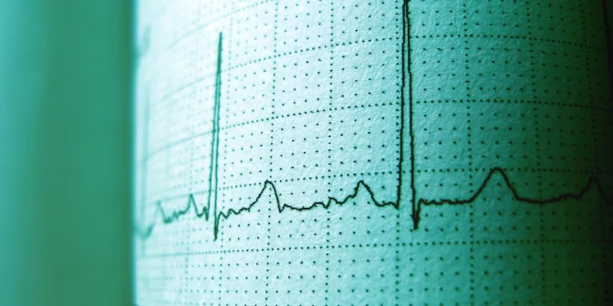 Resmi Berlaku: Regulasi WPT Terbaru di Indonesia dan Pengaturan Spektrum Frekuensinya