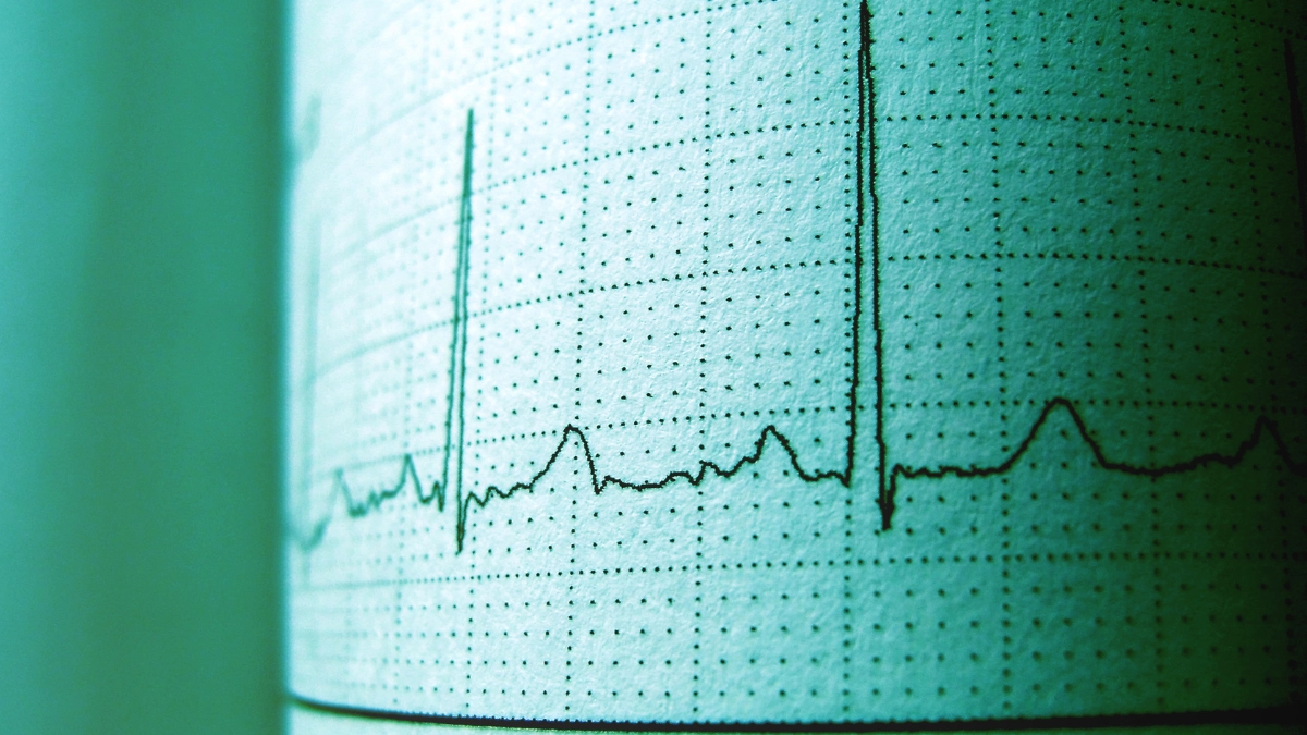 Spektrum Frekuensi untuk WPT