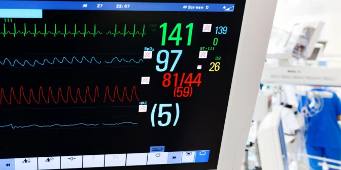 jenis patient monitor