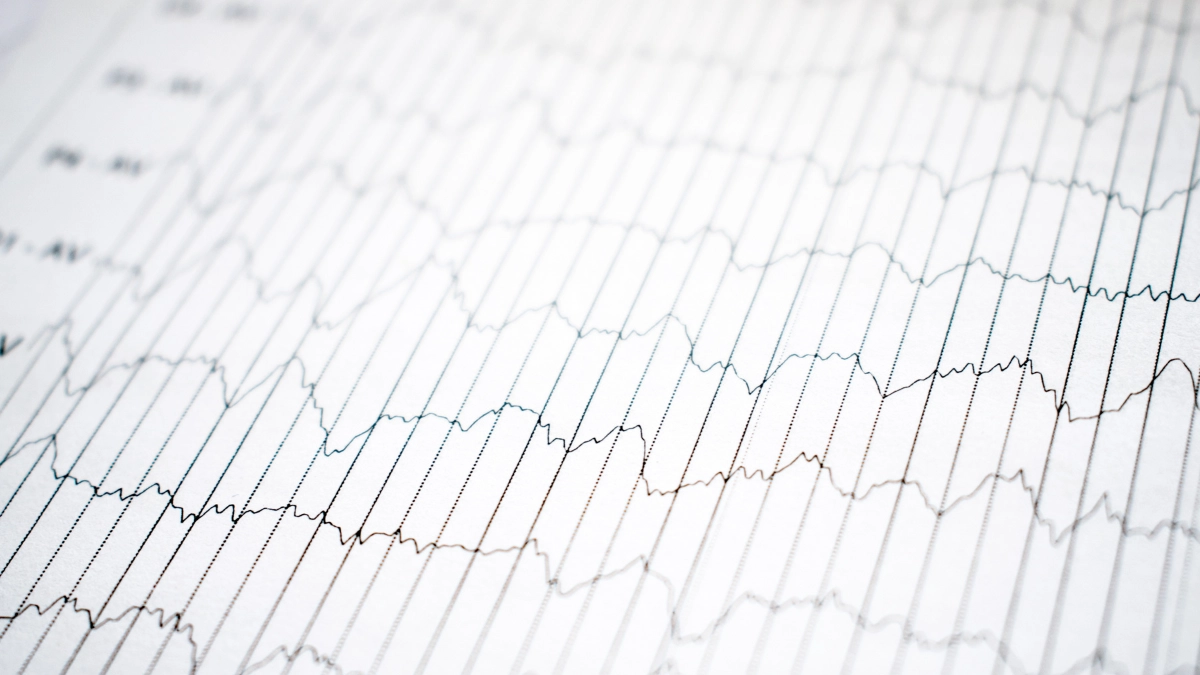harmonic emission - Narmadi.co.id