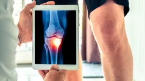 kelebihan flat panel detector - Narmadi.co.id