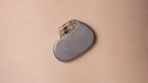 cara kerja alat pacu jantung - Narmadi.co.id