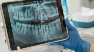 jenis flat panel detector - Narmadi.co.id