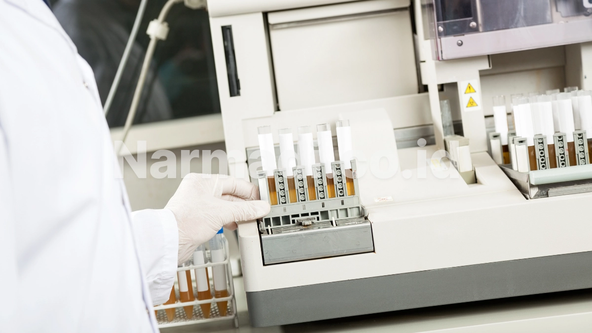 urinalysis analyzer - Narmadi.co.id