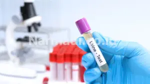 keunggulan urinalysis analyzer - Narmadi.co.id