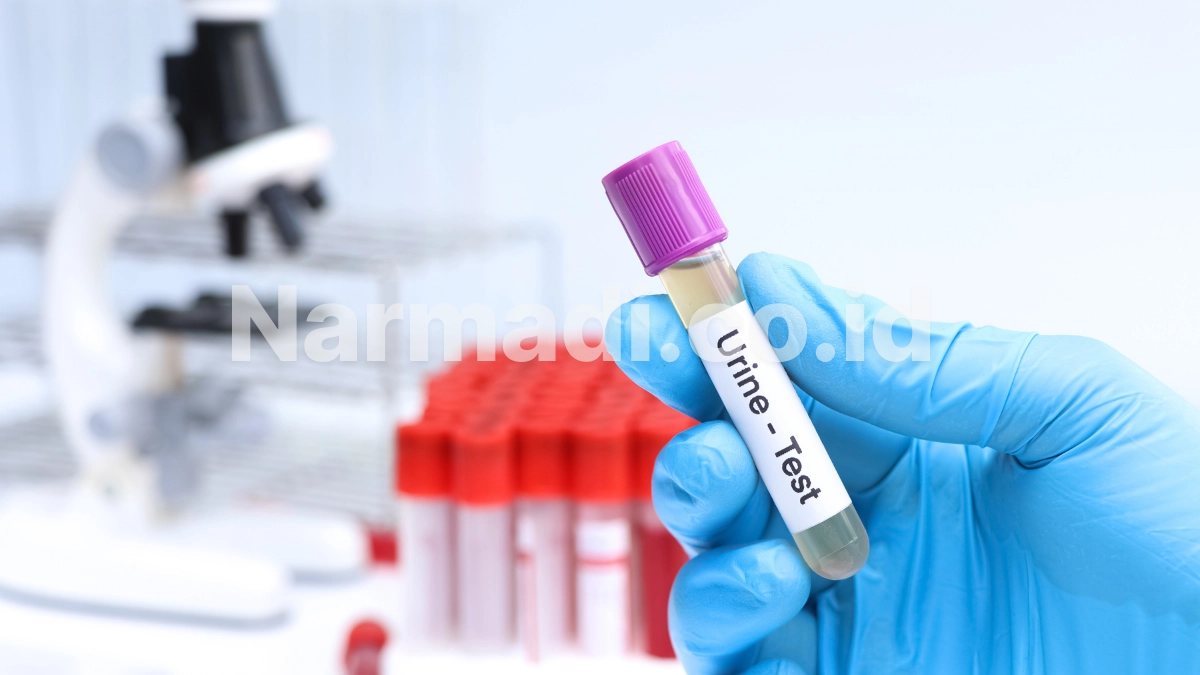 keunggulan urinalysis analyzer - Narmadi.co.id