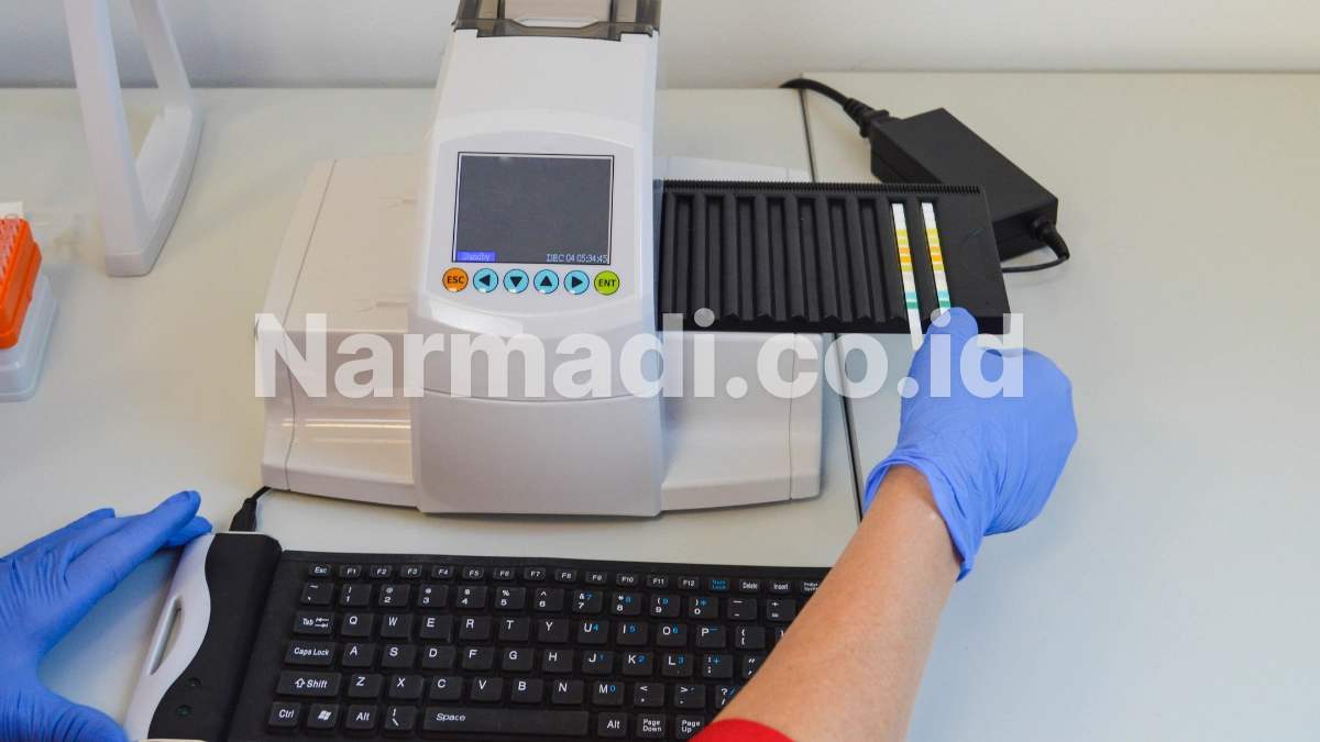 Apa itu Urinalysis Analyzer?