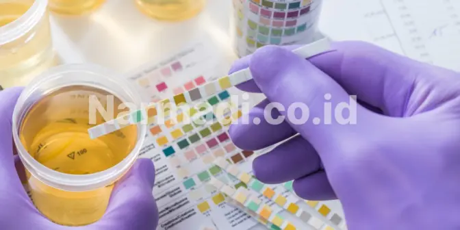Kenali 4 Jenis Urinalysis Analyzer Sebelum Membeli untuk Klinik atau Rumah Sakit