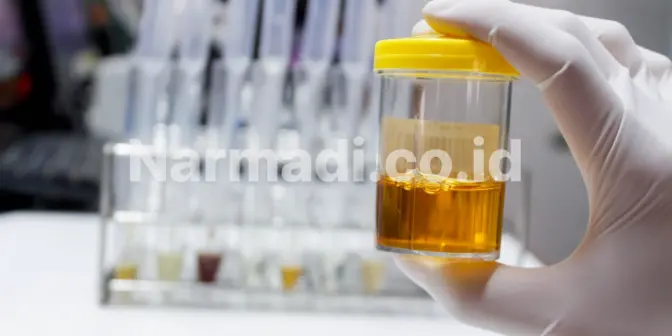 Cara Kerja Urinalysis Analyzer: Begini Proses di Balik Tes Urin Otomatis yang Akurat