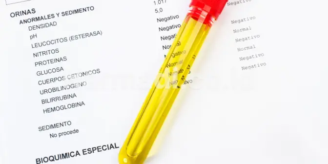 8 Keunggulan Urinalysis Analyzer yang Bikin Proses Tes Urin Lebih Cepat dan Akurat