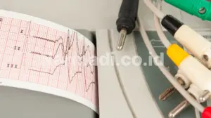 jenis elektrokardiograf - Narmadi.co.id