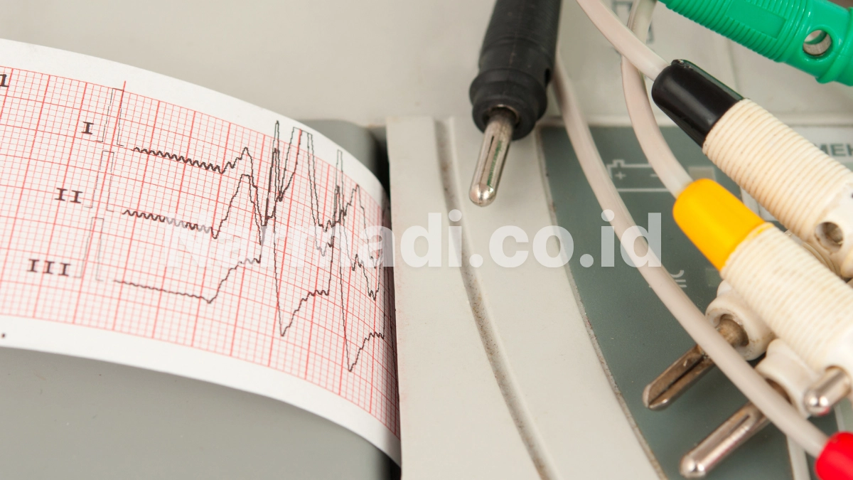 jenis elektrokardiograf - Narmadi.co.id