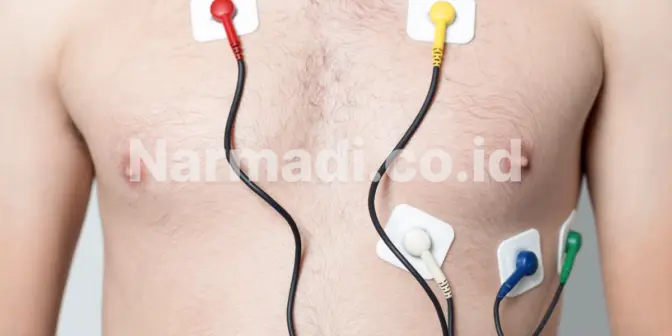 Bagaimana Cara Kerja Elektrokardiograf Begini Penjelasannya
